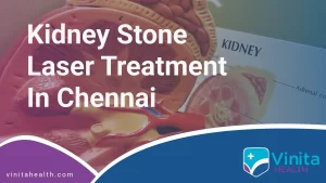 Kidney Stone Laser Treatment in Chennai