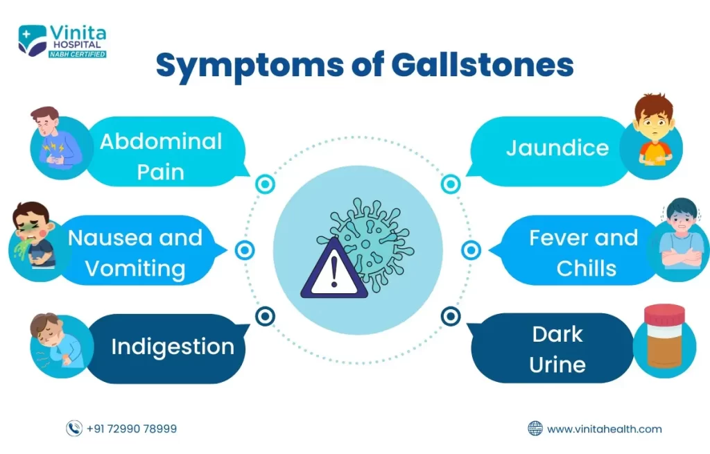 Natural Treatment for Gallstones