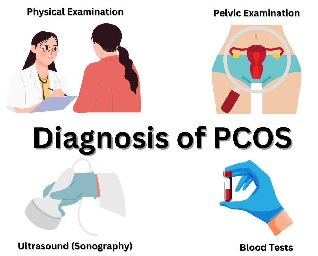 Diagnosis of PCOS