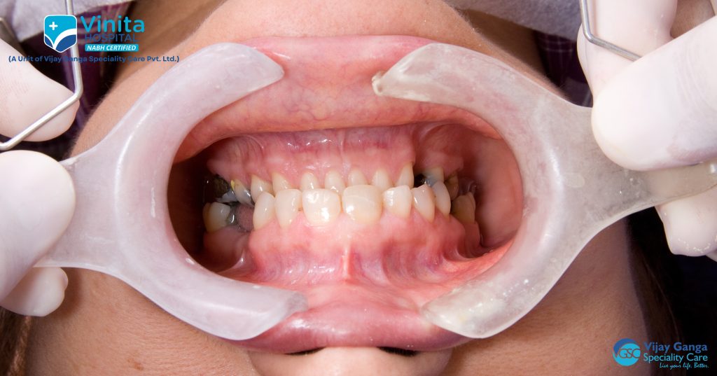 Dental Care 5 Dental 005