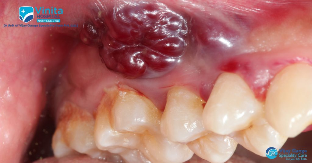 Dental Care 11 Dental 011
